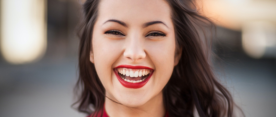 What is a gummy smile?