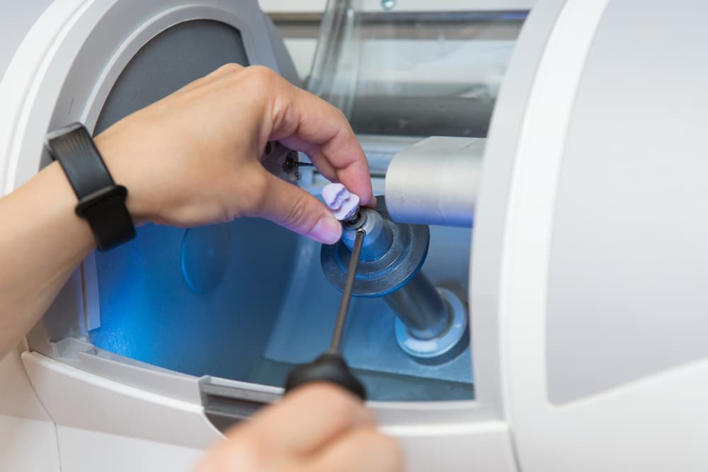 CEREC Same Day Restorations in Darwin for a Faster Smile Solution